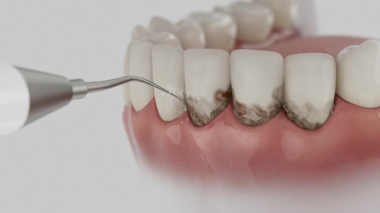 Trusted Wisdom Tooth Removal service in Lemoore Station, CA - Dentist Open Now